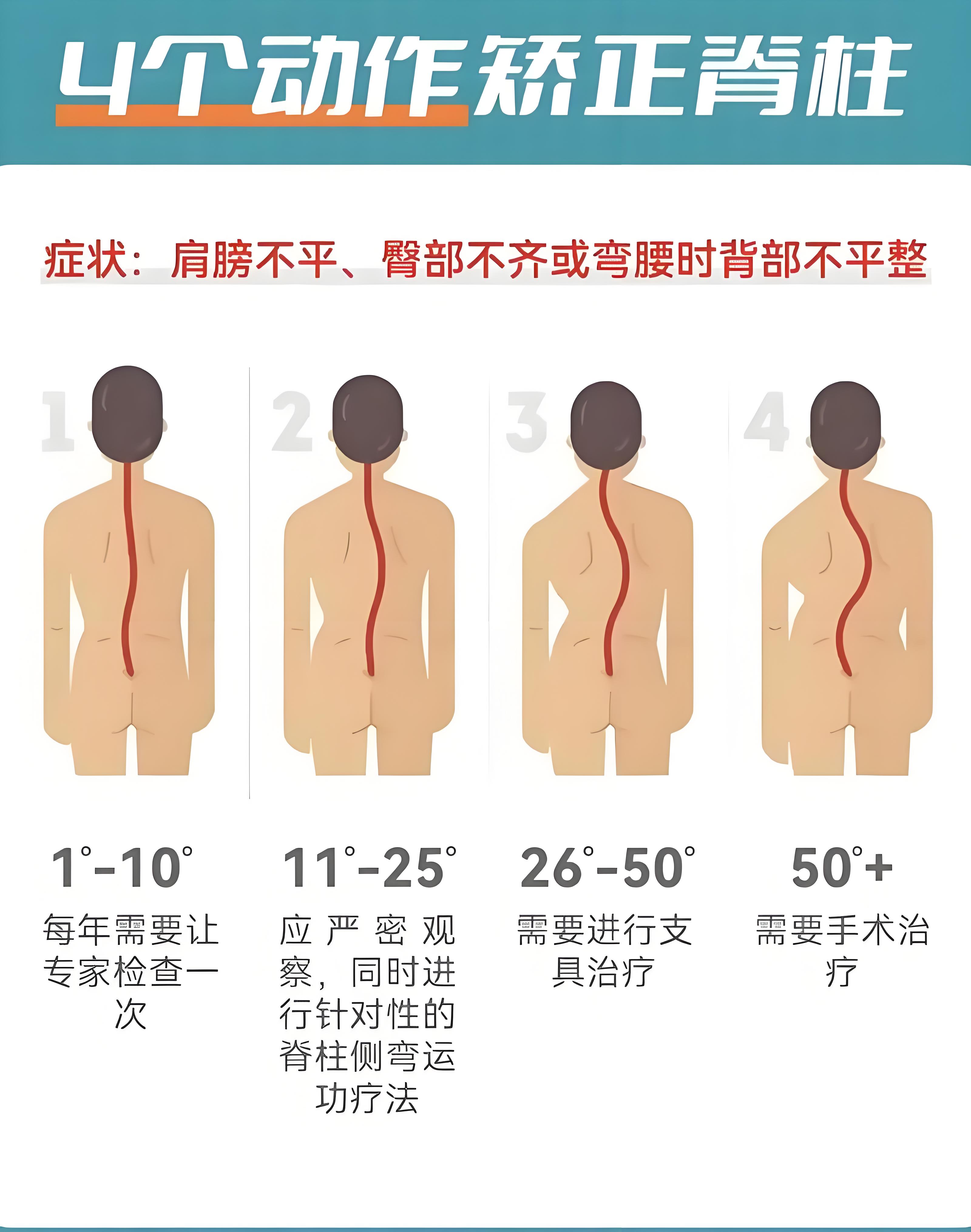脊柱侧弯自我矫正法